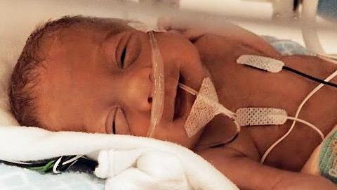 Πρόωρα μωράκια... χαμογελούν γιατί βγήκαν νικητές!