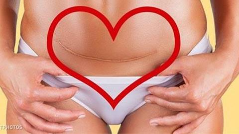 «Ο τρόπος που γεννάς δεν ορίζει το πόσο δυνατή είσαι»