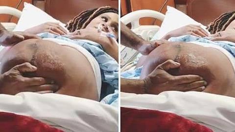 Απίστευτο βίντεο: Γιατρός αλλάζει θέση σε μωρό που κατέβαινε ανάποδα