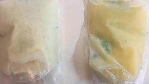 Ο λόγος που το μητρικό γάλα αλλάζει χρώμα όταν το μωρό αρρωσταίνει