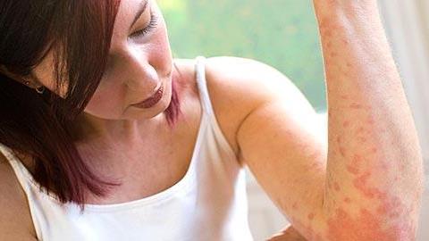 Αυτοάνοσα νοσήματα: 7 σημάδια που πρέπει να γνωρίζετε