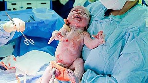 Ζητώ να γεννήσω με φυσιολογικό τοκετό κι όχι με καισαρική: Η επιστολή μιας γυναίκας στον Υπ. Υγείας