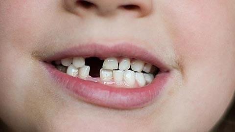 Γιατί η κόρη μου τρίζει συνέχεια τα δόντια της όταν κοιμάται;