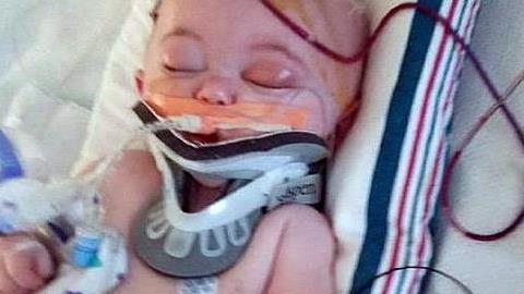 «Μια απλή πτώση από το κρεβάτι απείλησε τη ζωή του μωρού μου»: Μια μαμά προειδοποιεί!