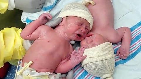 Ο ξεχωριστός δεσμός των διδύμων ξεκινά από τη γέννησή τους: Ένα συγκινητικό βίντεο!