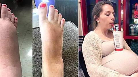 Οι καλές, οι κακές και οι αστείες στιγμές της εγκυμοσύνης!