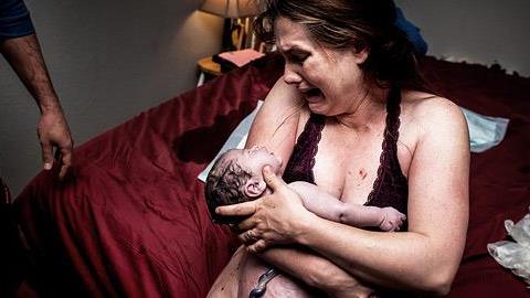 Οι φωτογραφίες τοκετού που απαγόρευσαν τα μέσα κοινωνικής δικτύωσης