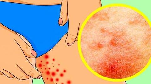 Πώς να αντιμετωπίσετε τα δερματικά προβλήματα του καλοκαιριού