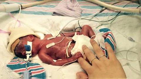 «Μπορείς να το κάνεις»: Πώς μια μαία έδωσε κουράγιο σε μια ετοιμόγεννη γυναίκα