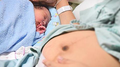 Γέννησα πριν 10 μήνες και σκέφτομαι να ξαναμείνω έγκυος. Είναι επικίνδυνη μια τρίτη καισαρική τόσο σύντομα;