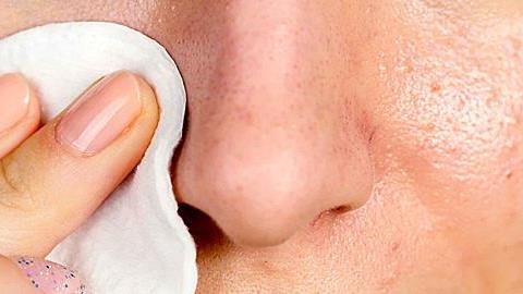 Πώς να ξεφορτωθείτε τα μαύρα στίγματα από το πρόσωπο