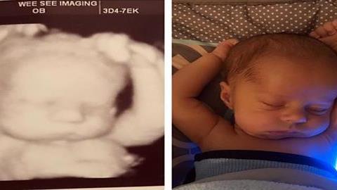 Νεογέννητο μωράκι κοιμάται με τον ίδιο τρόπο που... χαλάρωνε στην κοιλιά της μαμάς του