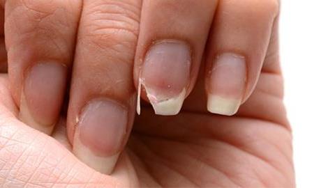 6 σημάδια που μαρτυρούν ότι έχετε έλλειψη ασβεστίου