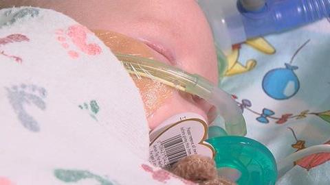 Βρεφική αλλαντίαση: Όσα πρέπει να γνωρίζουμε για την θανατηφόρο δηλητηρίαση 