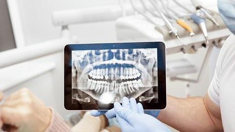 Έκανα πανοραμική δοντιών ενώ δεν ήξερα ότι είμαι έγκυος. Υπάρχει περίπτωση να έχει πρόβλημα το έμβρυο λόγω ακτινοβολίας;