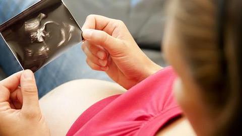 «Δεν έμαθα το φύλο του παιδιού μέχρι την γέννηση και ήταν η καλύτερη επιλογή» 