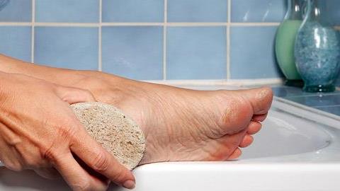 Πώς να αντιμετωπίσετε τους κάλους με φυσικό τρόπο 