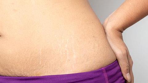 Πώς θα χάσω τα κιλά της εγκυμοσύνης;