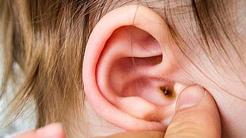 Το αυτί του 5 μηνών γιου μου παρουσιάζει έντονο ερεθισμό. Τί μπορεί να είναι;