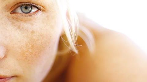 Πανάδες από τον ήλιο: 5 μυστικά ομορφιάς για να τις καλύψετε 