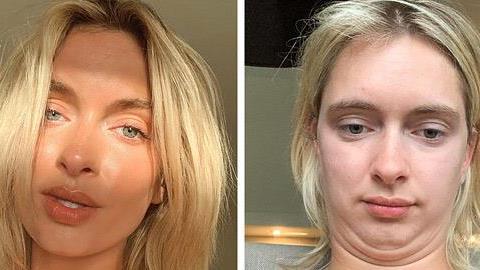 Μια σταρ του Instagram αποκαλύπτει την πραγματικότητα πίσω απ' την «τέλεια» εικόνα της! 