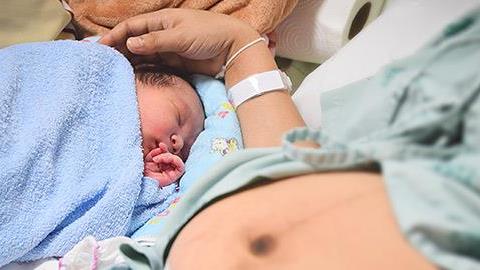 Καισαρική τομή: 7 λανθασμένες αντιλήψεις και ποια η πραγματικότητα