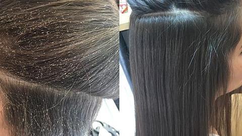 Lice busters: το πρώτο κέντρο αντιμετώπισης ψείρας! 