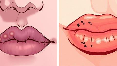 Ποια προβλήματα υγείας μαρτυρά η κατάσταση των χειλιών μας;