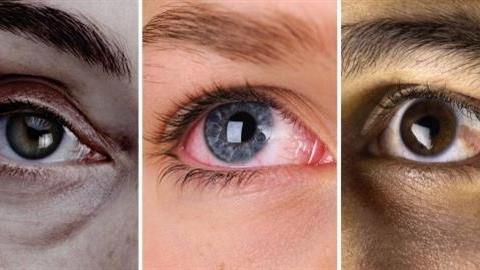 Τα μάτια είναι ο καθρέφτης της ψυχής, αλλά και της υγείας σας
