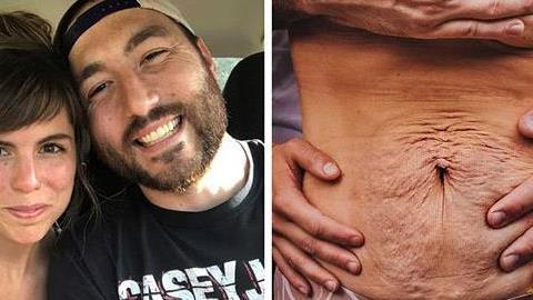 «Μπορεί το σώμα της γυναίκας μου να άλλαξε, αλλά για μένα είναι πιο ερωτεύσιμη από ποτέ»