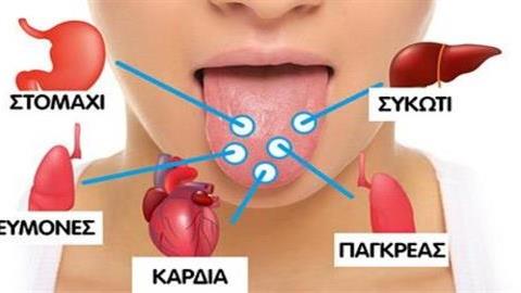 Ποια πρόβληματα υγείας μαρτυρά η κατάσταση της γλώσσας μας