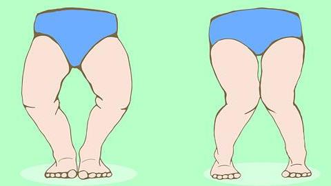 Πώς αναπτύσσονται τα ποδαράκια του μωρού και πότε πρέπει να ανησυχήσουμε