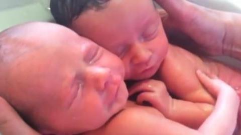 Τα δίδυμα που αγκαλιάζονται όπως όταν ήταν στην κοιλιά της μαμάς τους (βίντεο)