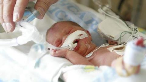 Νεογέννητο νόσησε απ’ τον κοροναϊό: τι λένε οι ειδικοί για την πιθανότητα μετάδοσης απ’ τη μητέρα