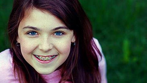 Όσα πρέπει να ξέρετε για την ορθοδοντική παιδιών