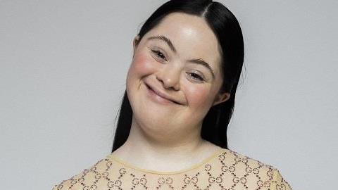 Το νέο μοντέλο του οίκου Gucci είναι ένα πανέμορφο κορίτσι με σύνδρομο Down!