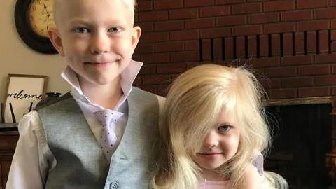 6χρονος ήρωας έσωσε την αδερφή του απ’ τα δόντια σκύλου με κίνδυνο της ζωής του