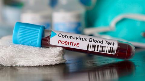 Πνευμονολόγος: «Όσοι δεν πιστεύουν στον κορονοϊό να έρθουν στις ΜΕΘ να δουν όσους νοσούν» 