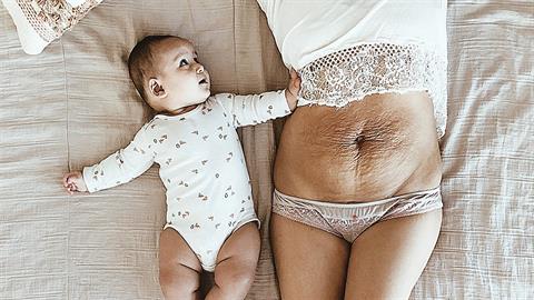 Το σώμα μου μετά τον τοκετό δεν ήταν «ελαττωματικό», αλλά πανέμορφο!