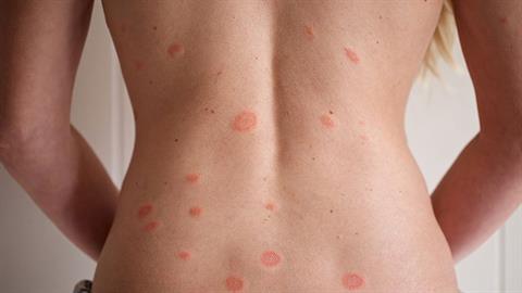 Η νόσος των δοκιμαστηρίων: το ότι δεν το ξέρετε δεν σημαίνει ότι δεν υπάρχει!