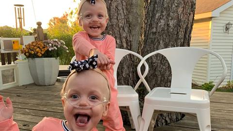 Τα πιο πρόωρα δίδυμα του κόσμου έγιναν 2 χρονών και μοίρασαν την ελπίδα