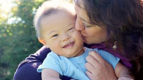 «Ο γιος μου έχει σύνδρομο Down και το πιο γλυκό χαμόγελο του κόσμου»