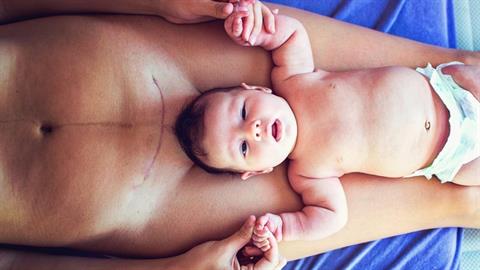 «Μη με κάνετε να ντρέπομαι επειδή γέννησα με καισαρική»