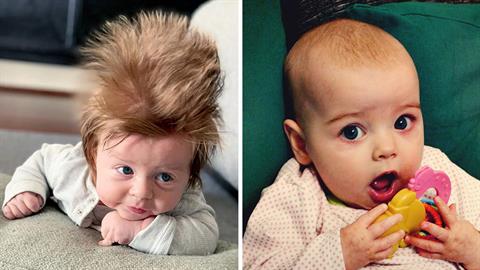 Γιατί κάποια μωρά γεννιούνται με μαλλιά και άλλα με... δυο τρίχες στην κεφαλή