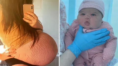 Μαμά γέννησε κοριτσάκι «γίγαντα» και η κοιλιά της ήταν σαν να περιμένει δίδυμα