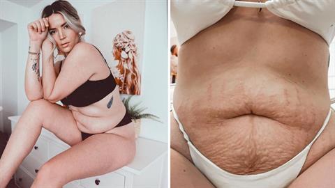 «Με είπαν χοντρή και αηδιαστική επειδή τόλμησα να δείξω το σώμα μου μετά τη γέννα»