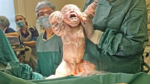 Μαμά γέννησε μωρό 5,7 κιλά και 60 εκ - δε χωρούσε στη ζυγαριά του νοσοκομείου