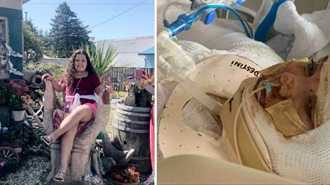 13χρονη νοσηλεύεται με σοβαρά εγκαύματα – θέλησε να μιμηθεί βίντεο στο Tik Tok