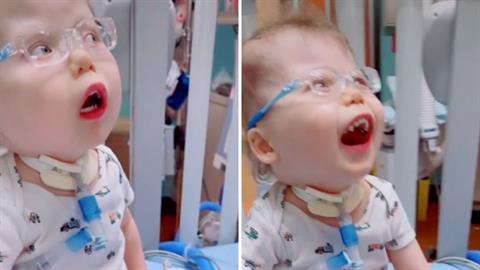 3χρονο αγοράκι με περιορισμένη όραση βλέπει για πρώτη φορά τους γονείς του