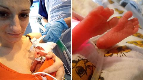 «Το μωρό μου γεννήθηκε τόσο μικρό που φοβόμουν ότι δεν θα τα καταφέρει ποτέ»